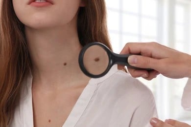 A dermatologist looking at a mole on a woman's neck